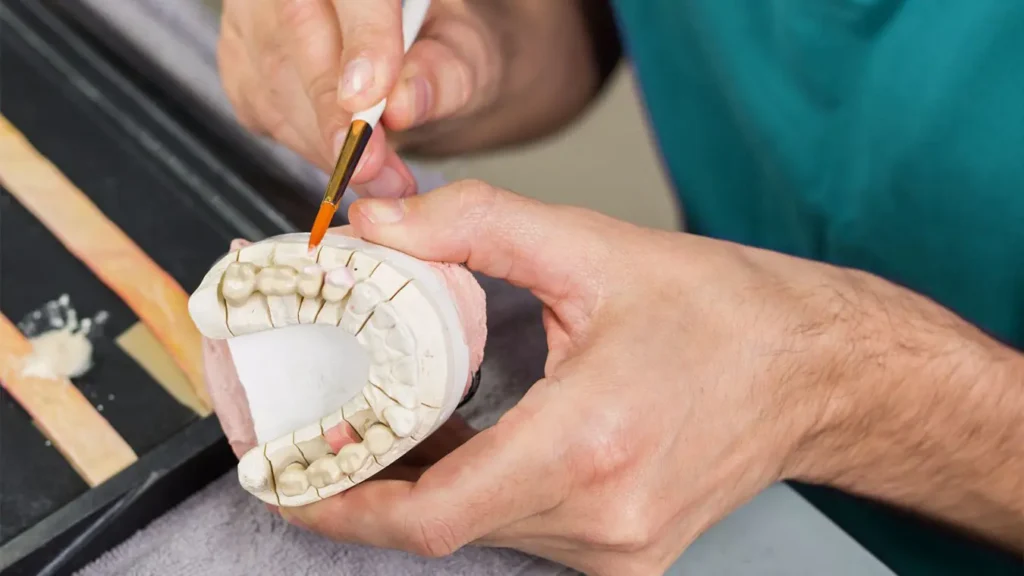 Técnico em prótese dentária trabalhando em laboratório odontológico com resina e equipamentos profissionais
