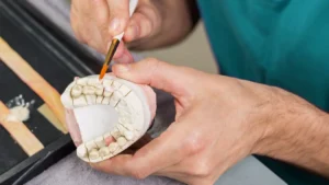 Técnico em Prótese Dentária no Senac:&hellip;
