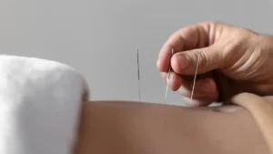 Senac tem pós-graduação em Acupuntura: 1.200h&hellip;